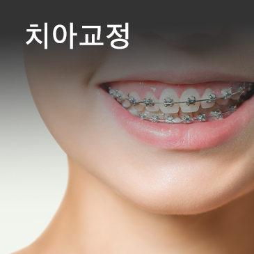 치아교정